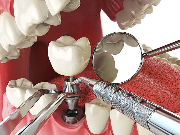 Best Walk-In Emergency Dentist in Monroe, MI